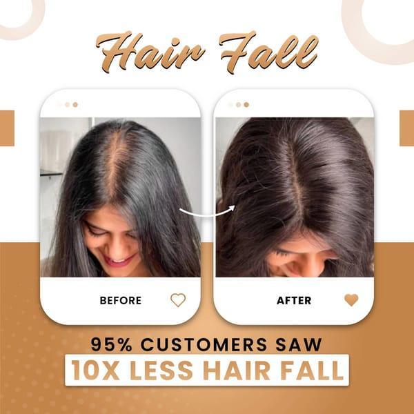 Premium Hair Oil for Hair Growth & Thickness – Anti Hair Fall Natural Oil 200ml